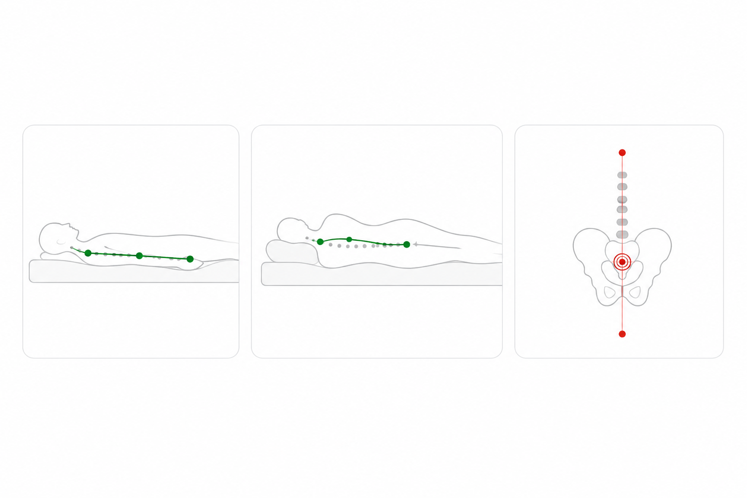 The Physics of Spinal Alignment